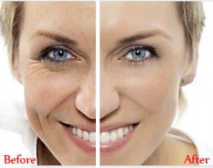 Allanah Serum