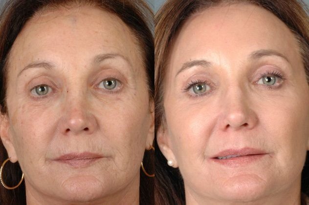 Eternal-Skin-Cream Eternal-Skin-Cream