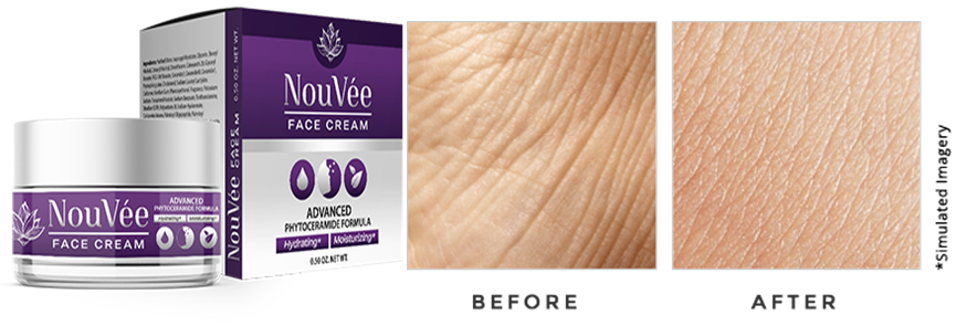 Nouvee Anti-aging Cream Nouvee Anti-aging Cream