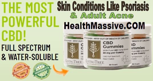 Living Tree CBD Gummies Living Tree CBD Gummies