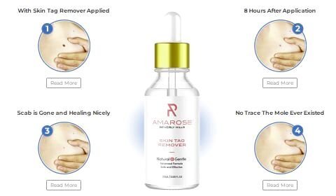 Amarose Skin Tag And Moles Remover Serum Amarose Skin Tag And Moles Remover Serum