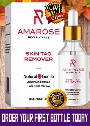 Amarose Skin Tag Remover Review