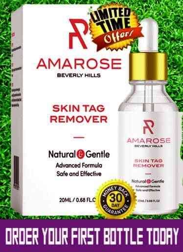 Amarose Tag Remover Review