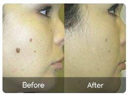 SkinCell Pro Real People, Real Results SkinCell Pro Real People, Real Results